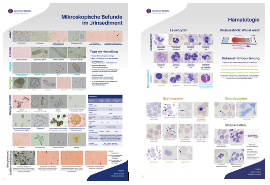 Poster Urinsediment Und Hämatologie